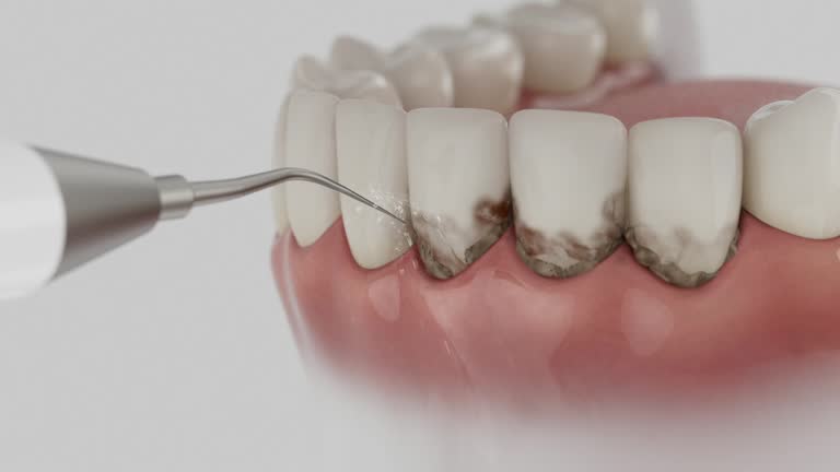 Reliable Dental contractor in Grayson, CA by Dentist Open Now